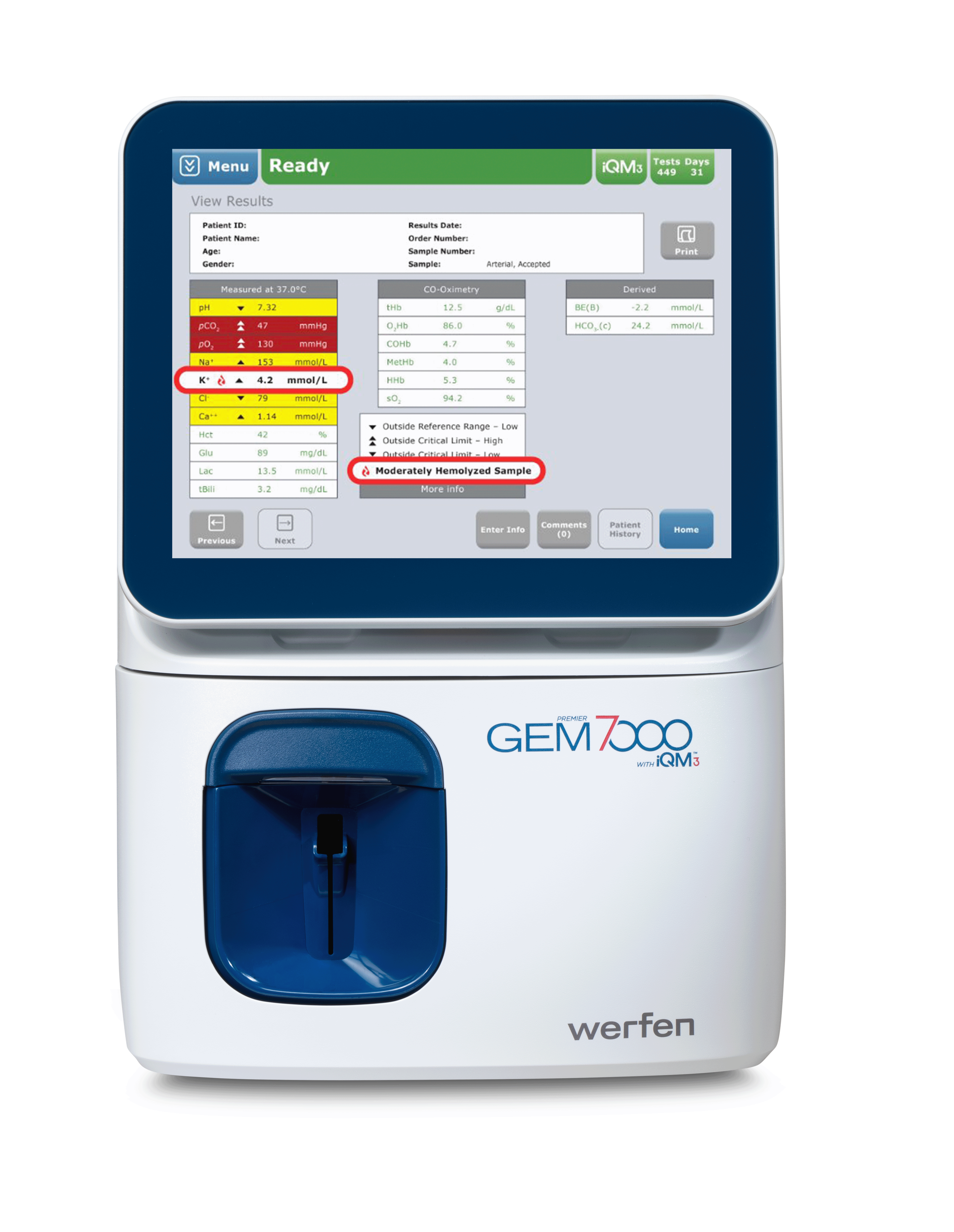 GEM Premier 7000 with iQM3 screen showing the hemolysis detection flag to the operator